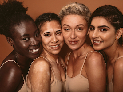 Portrait of four young women with different skin types. Diverse group of females standing together and looking at camera, beauty industry